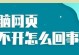 探究电脑设置打开显示网页错误的原因及解决方法（解析网页显示错误的常见原因与应对策略）